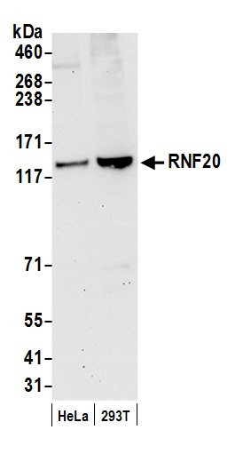 Anti-RNF20