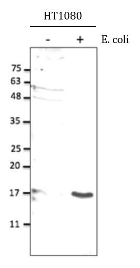 Anti-IL10