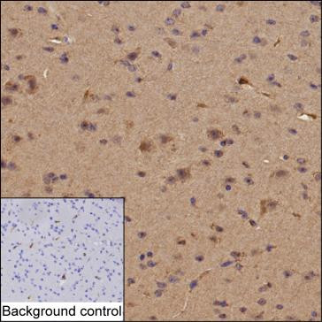 Anti-SIRT1