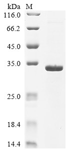 Matrix protein (M), Rabies virus, recombinant