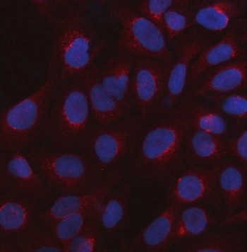 Anti-5-HT3C / 5-hydroxytryptamine receptor 3C / HTR3C