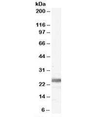 Anti-Ribosomal Protein L19