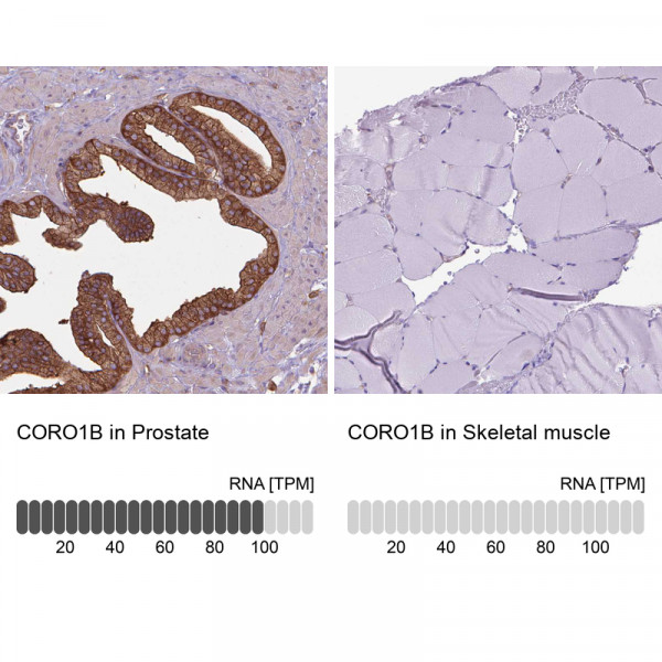 Anti-CORO1B