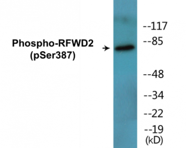 RFWD2 (Phospho-Ser387) Colorimetric Cell-Based ELISA Kit