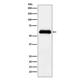 Anti-Alpha-1-Antichymotrypsin / AACT / SERPINA3, clone ADED-19