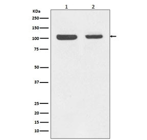Anti-Retinoblastoma / Rb1, clone FCD-18
