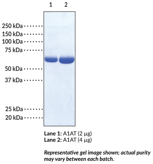 Alpha-1 Antitrypsin