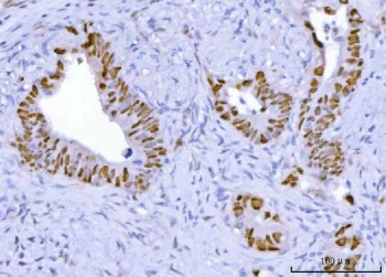 Anti-TP53 / Cellular tumor antigen p53