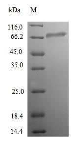 Acetyl-coenzyme A synthetase 2-like, mitochondrial (ACSS1), human, recombinant