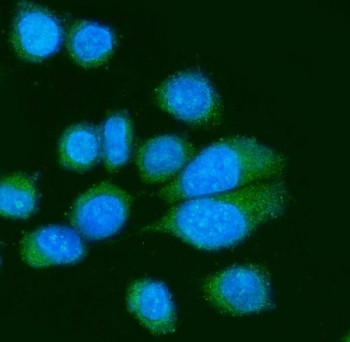 Anti-Poliovirus Receptor / PVR