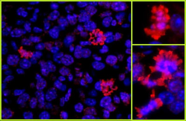 Anti-Histone H3 (IHC)