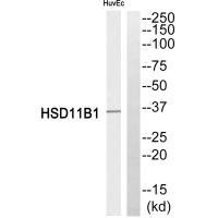 Anti-HSD11B1
