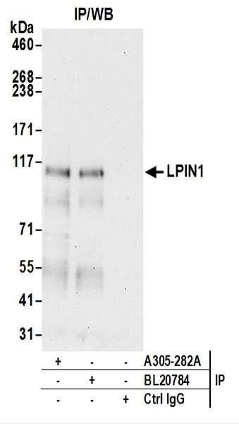 Anti-LPIN1