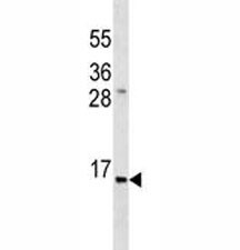 Anti-Insulin, clone 396CT20.4.4