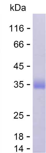 Recombinant Human PR3 Protein