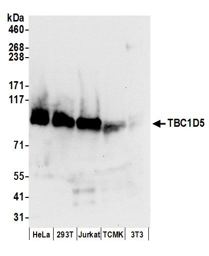Anti-TBC1D5