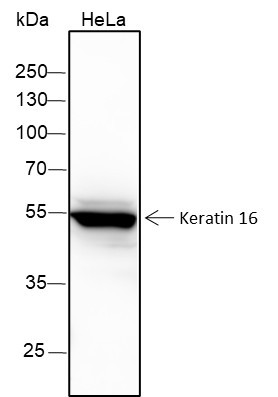 Anti-Recombinant Keratin 16, clone A274