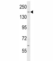Anti-IQGAP2