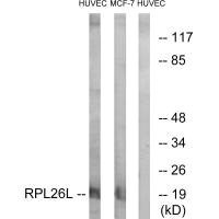Anti-RPL26L1