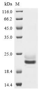 E3 ubiquitin-protein ligase ZNRF3 (ZNRF3), partial, human, recombinant
