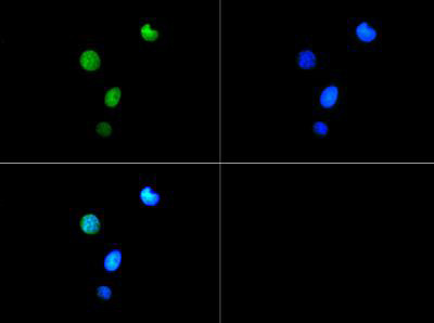 Anti-phospho-trimethyl-Histone H3 (Trimethyl Lys9, p Thr6)