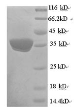 Mitochondrial brown fat uncoupling protein 1 (UCP1), human, recombinant