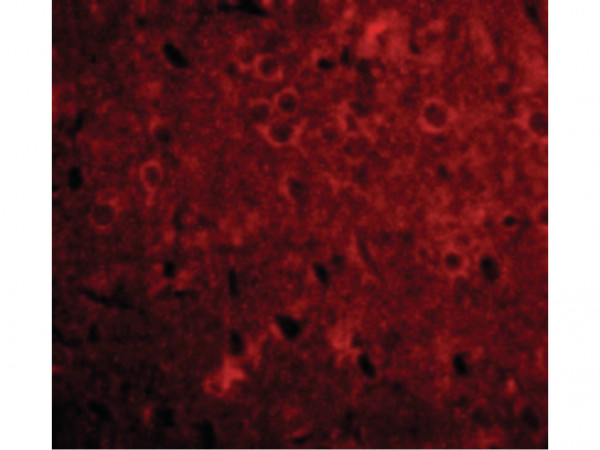 Anti-GPAT1