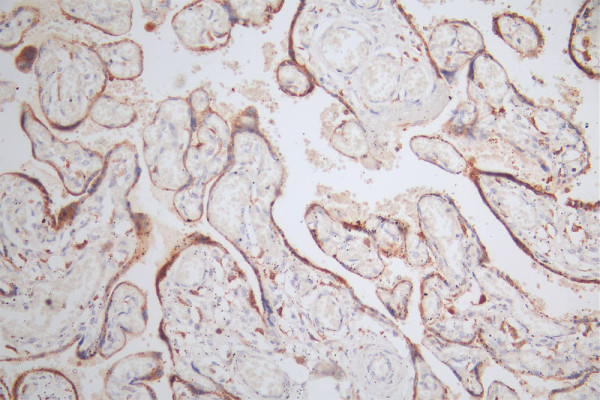 Anti-NAIP Recombinant Monoclonal, clone 13E6