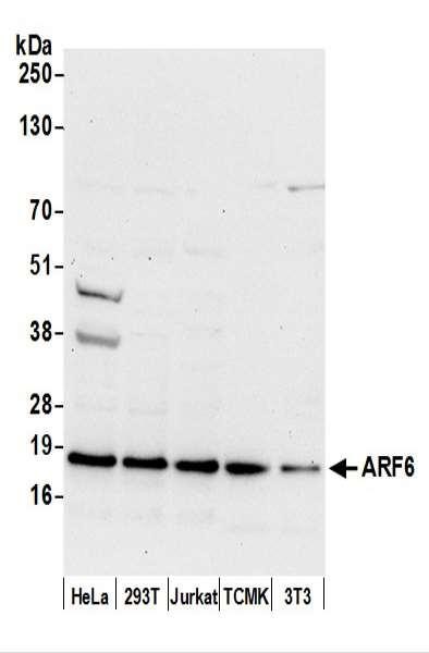 Anti-ARF6/ADP Ribosylation Factor 6