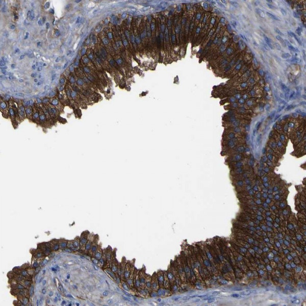 Anti-CD151