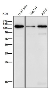 Anti-DSC1 / Desmocollin 1, clone 31D56