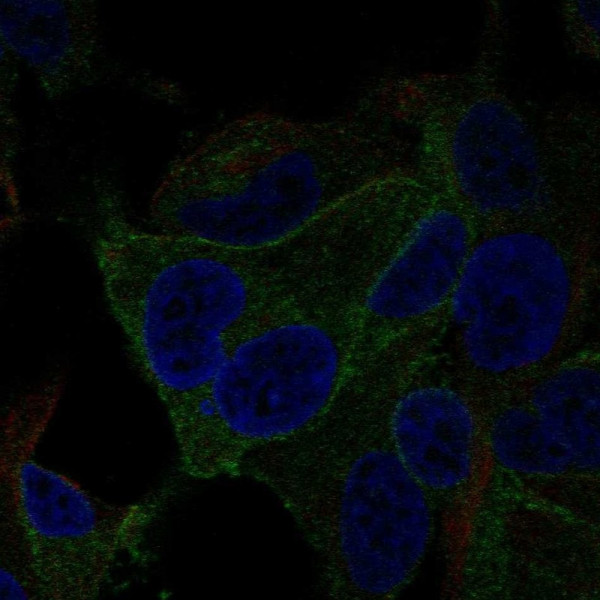 Anti-TRPV2