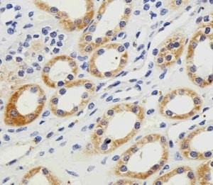 Anti-PGK1