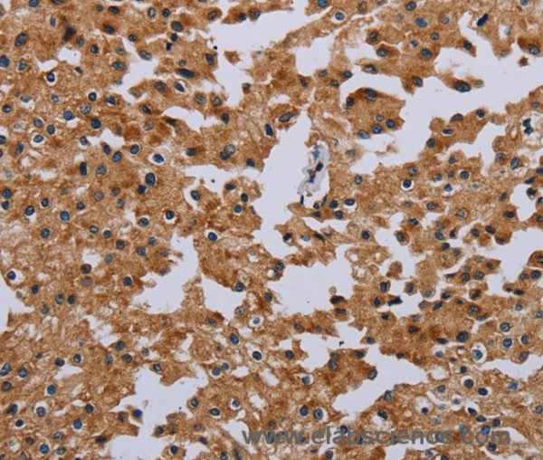 Anti-IFRD1