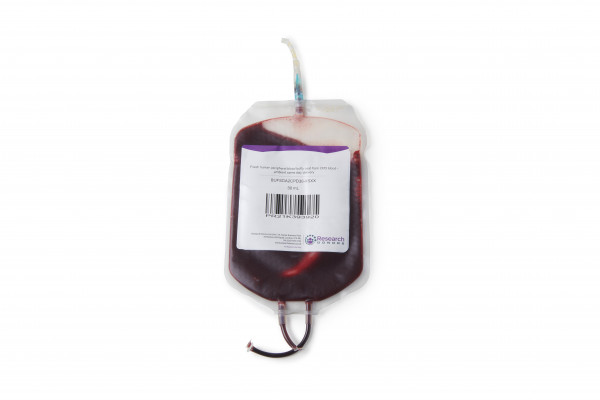 Fresh human peripheral blood buffy coat from sodium citrate blood - chilled overnight delivery