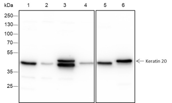 Anti-Recombinant Keratin 20, clone A277