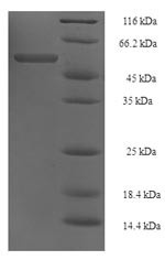 Elongation factor Tu (tuf1), Acinetobacter baumannii, recombinant