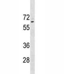 Anti-p63, clone 603CT12.4.3