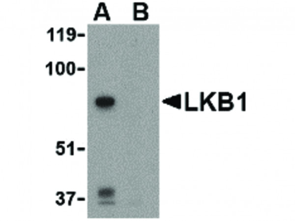 Anti-LKB1