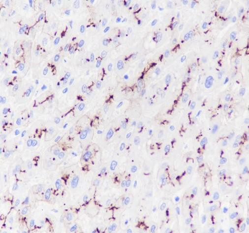 Anti-Recombinant ABCB11/BSEP, clone A145