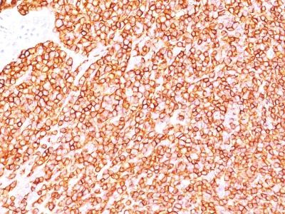 Anti-CD45RB (B-Cell Marker)(Clone: BRA-11, same as BRA-11G)