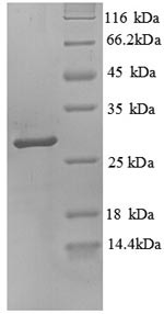 Trypsin-3 (PRSS3), partial, human, recombinant
