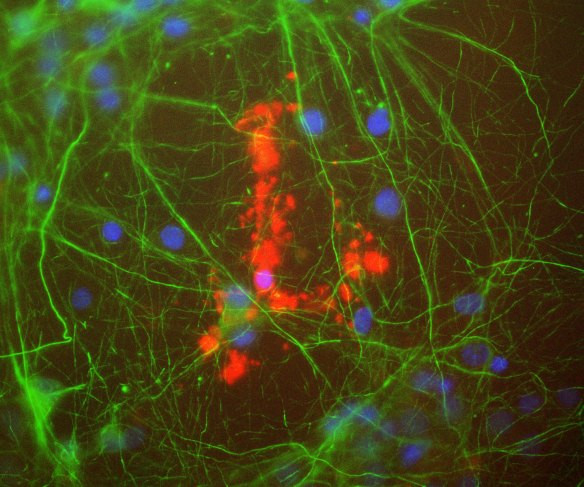 Anti-Myelin Basic Protein, clone 7D2