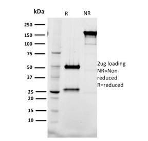 Anti-TAL1 / T-cell acute lymphocytic leukemia protein 1, clone BTL73