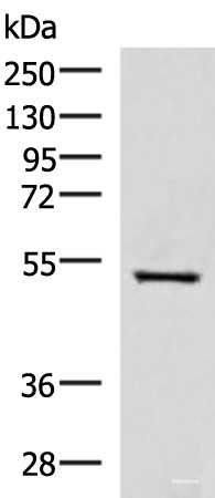 Anti-FDXR