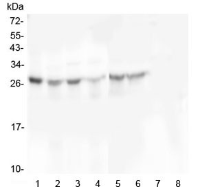 Anti-SCN4B