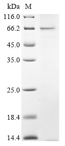 Endogenous retrovirus group K member 7 Env polyprotein (ERVK-7), human, recombinant