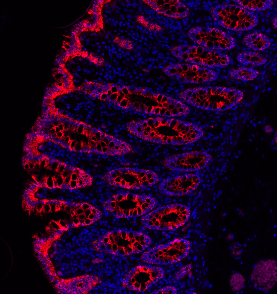 NaveniFlex Tissue MR RED