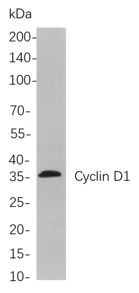 Anti-Recombinant Cyclin D1, clone 5A3