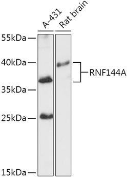 Anti-RNF144A